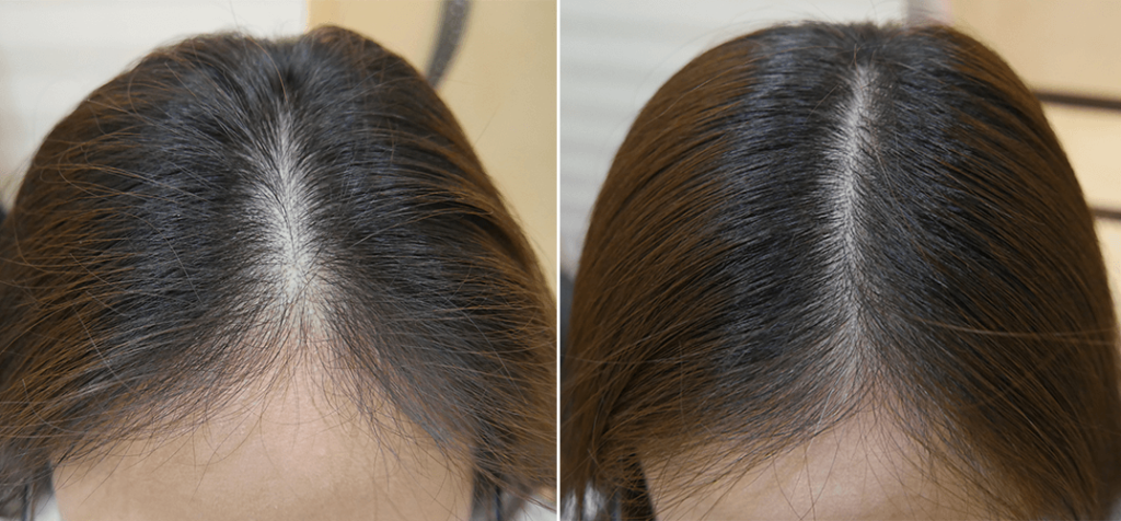 How Castor Oil is Effective for Your Thinning Hair